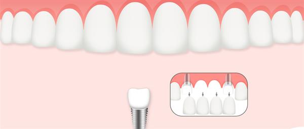 濟南口腔醫(yī)學(xué)專業(yè)學(xué)校是什么層次的學(xué)校？學(xué)校怎么樣？