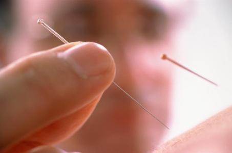 石家莊炎黃針灸推拿學(xué)校：針灸推拿有哪些好處？